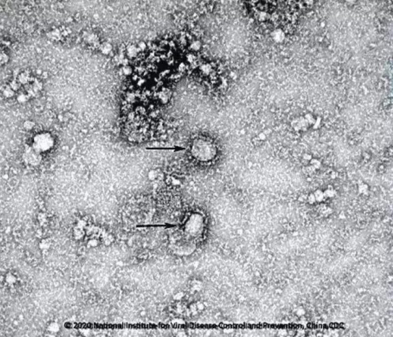 ▲新型冠狀病毒武漢株01。照片來源：國家病原微生物資源庫（中國疾病預(yù)防控制中心病毒病預(yù)防控制所）